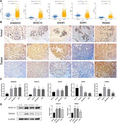 Cuproptosis/ferroptosis-related gene signature is correlated with immune infiltration and predict the prognosis for patients with breast cancer